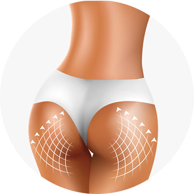 Beauty Booty Doskonałe pośladki